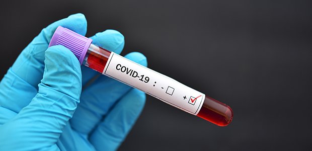 Garuva chega aos 330 casos positivos de COVID-19, mas 137 já estão recuperados.